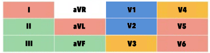 Navne på elektroder